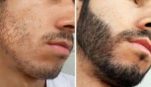 Como preencher a barba